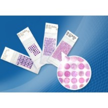 前列腺癌TMA (prostate TMA)