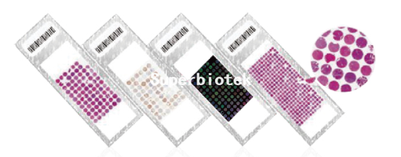 組織晶片（Tissue Microarray, TMA）